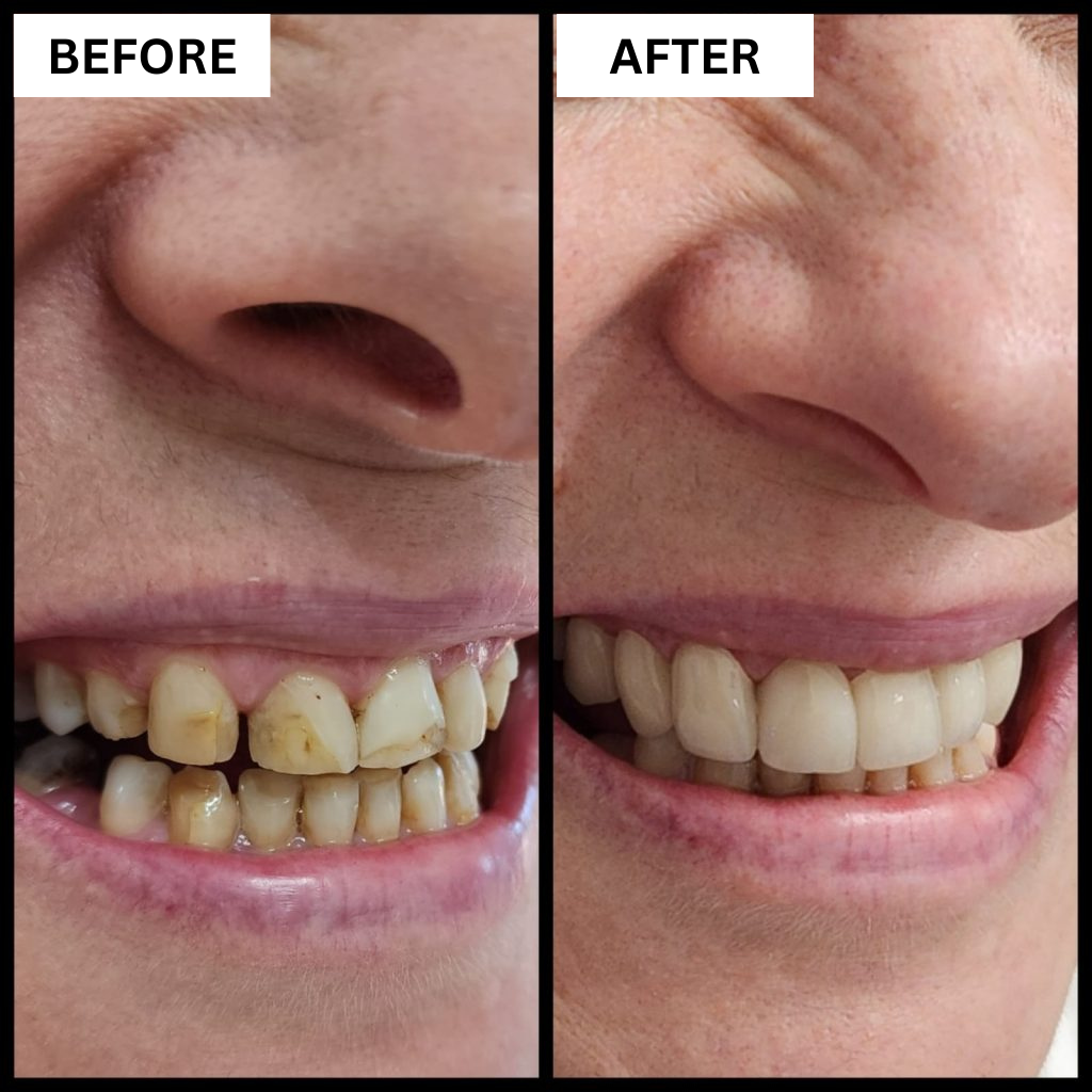 Before and after dental treatment result